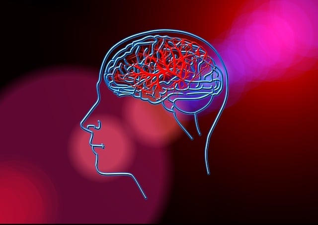 accident vasculaire cerebral