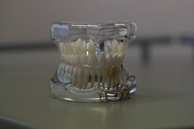 dentier, source https://pixabay.com