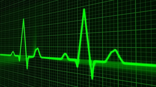 ECG, deux complexe p QRS T, source https://pixabay.com
